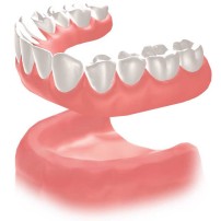 従来の治療方法　総入れ歯