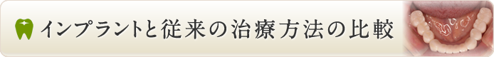 インプラントと従来の治療方法の比較