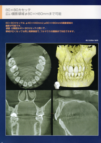 最新医療機器による精密治療03