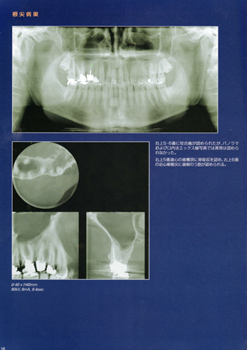 最新医療機器による精密治療06